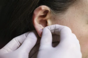 Ear piercing with gloved hands